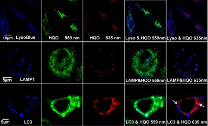Scientific research achievements of Associate Researcher Liu Xiangjun | Fluorescent probe HQO—accurately traces mitophagy