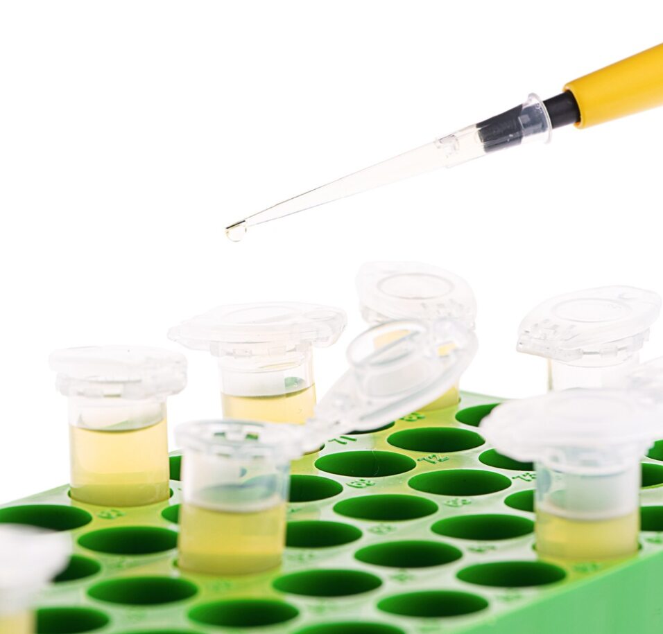 Correct Usage Method and Steps for Pipettes