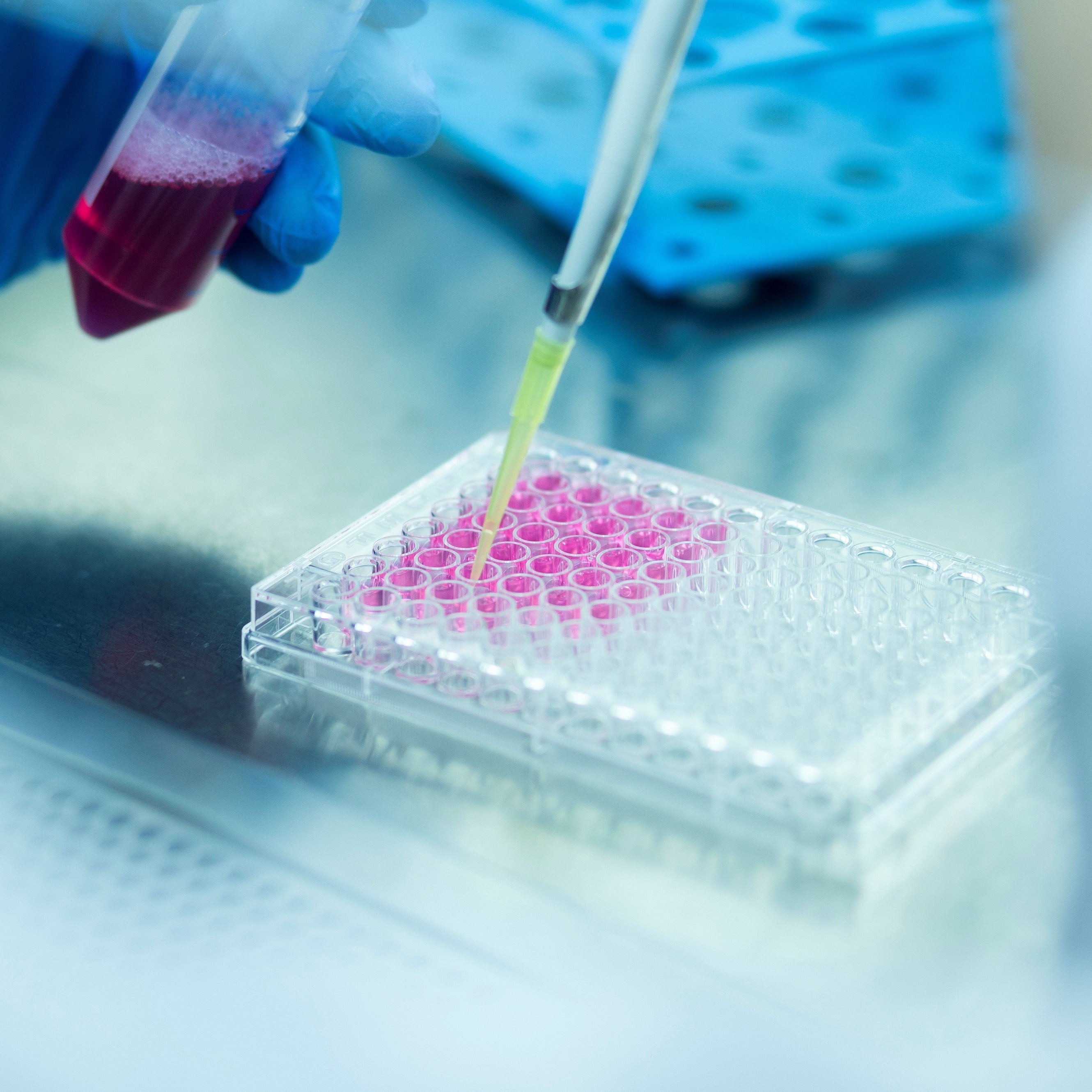 Alkaline Phosphatase (ALP) – Advancing Disease Diagnosis